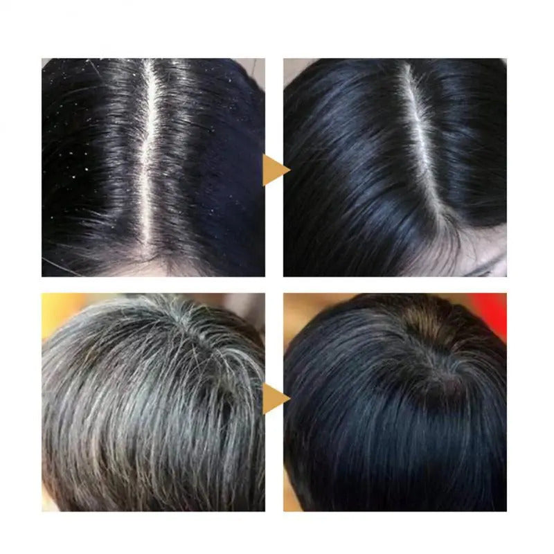 NUTRIBLACK™ - INGREDIENTES 100% NATURALES