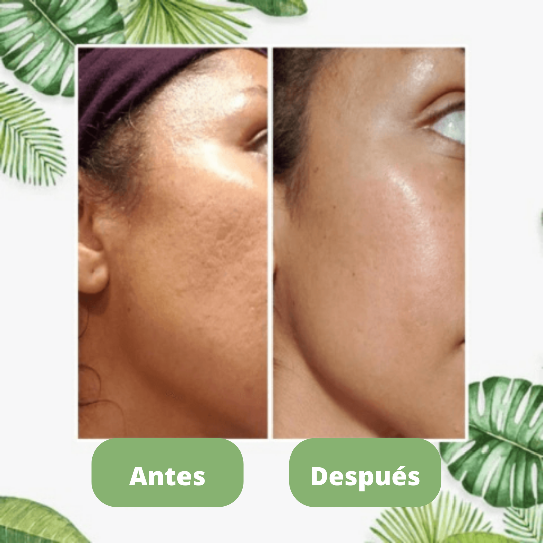 GreenStick™ - Mascarilla limpiadora poros